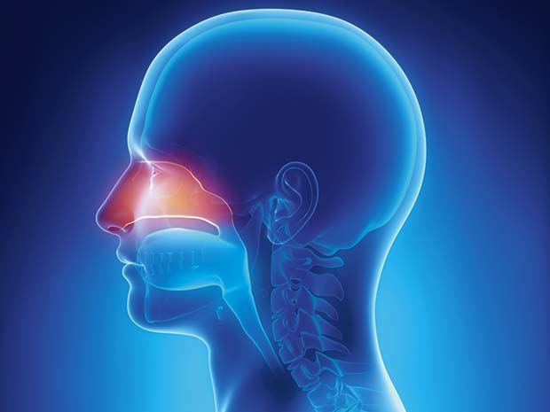 rhinosinusitis